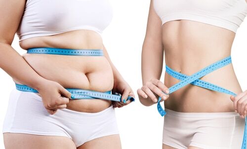 Weight Management Program in Buffalo, NY