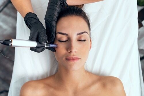 Micro-Needling in Buffalo, NY