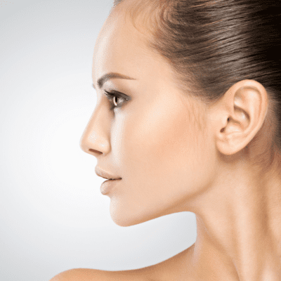 Double Chin Treatment in Buffalo, NY | Kybella vs. Morpheus8