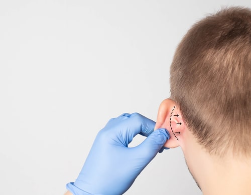 Ear Surgery Plastic Surgery Photos